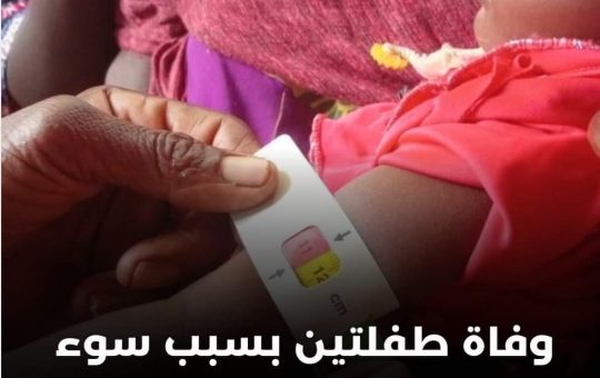 السودان – “الفضاء نيوز”:  *وفاة طفلتين بسبب سوء التغذية الحاد في الكلاكلة*   