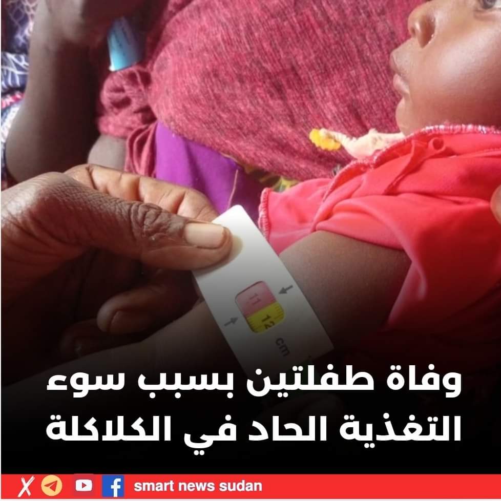 السودان – “الفضاء نيوز”:  *وفاة طفلتين بسبب سوء التغذية الحاد في الكلاكلة*   